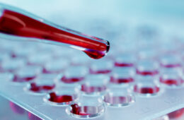 El cuidado de la sangre desde la distancia gracias a la hematología digital